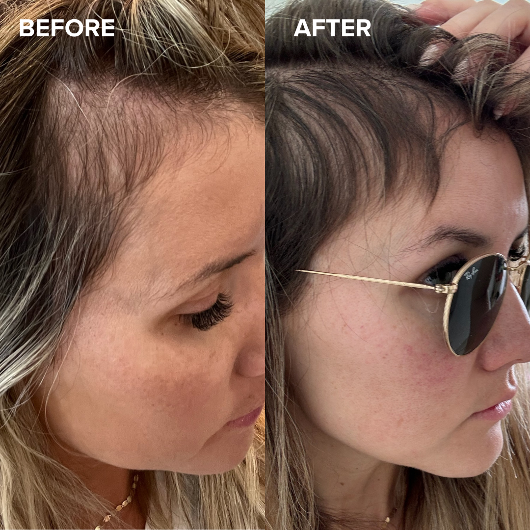 Scalp Serum